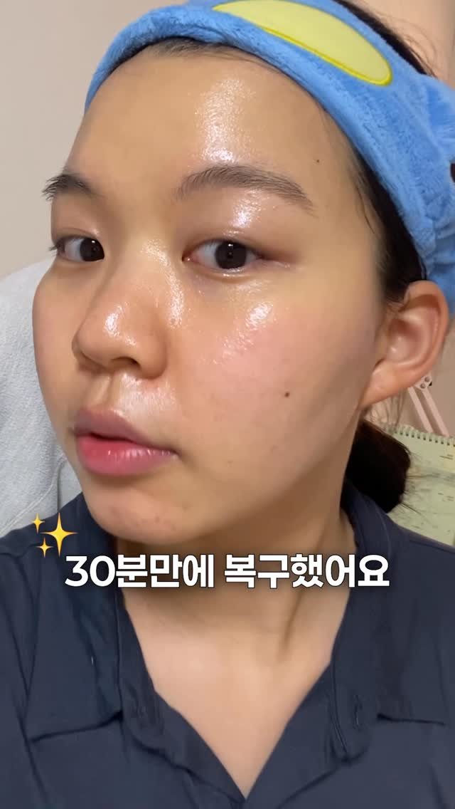 chaeng_trovely 게시물 이미지: 뒤집어진 피부 30분만에 복구해버림..✨(내돈내산찐템소개당)

[챙의 피부...
