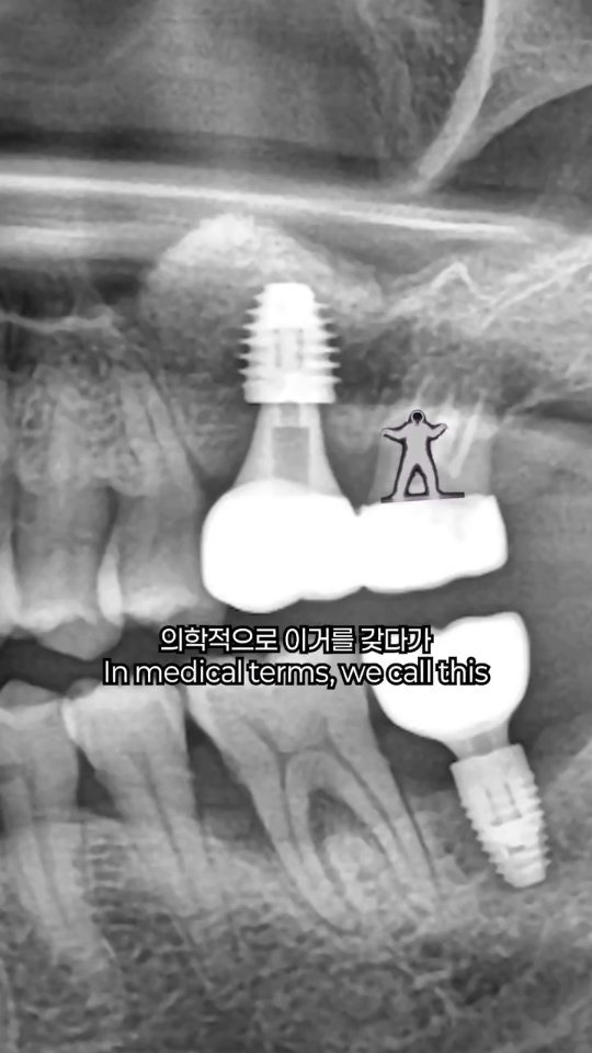 chee_jaeee 게시물 이미지: 사실 저도 그러합니다

#대구365치과 #치과의사 #치과 #dentist #대구치과