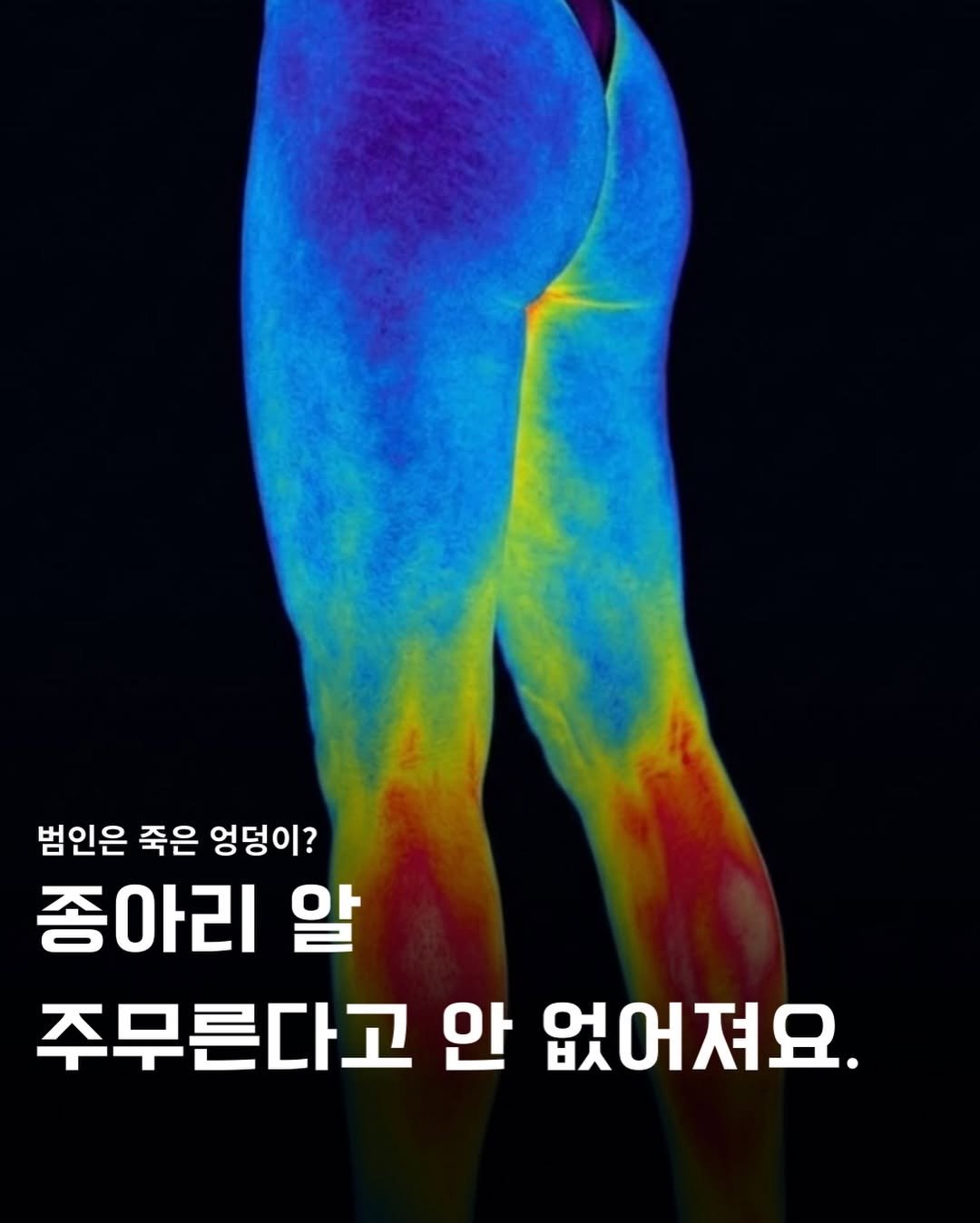 Photo by 바른몸 신선생 | 8년차 트레이너의 꿀팁 모음집 on January 03, 2026. May be an image of text that says '범인은 죽은 엉덩이? 종아리 알 주무른다고 안 없어져요.'.