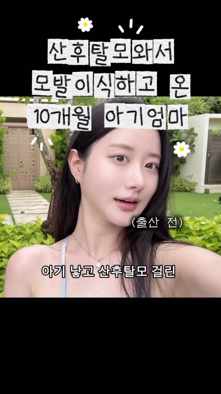 chichipresso 게시물 이미지: 참고로 영상은 머리심은지 3일차지만 지금은 7일차에용 😖
실시간 후기는 인스타...