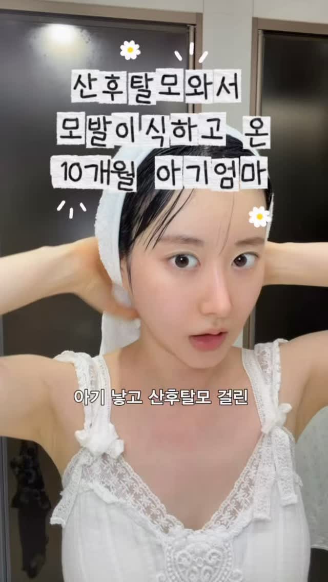 chichipresso 게시물 이미지: 산후탈모 모발이식 2일차 븨로그 🪽

시술 후 언제부터 일상생활 가능한지 물어...