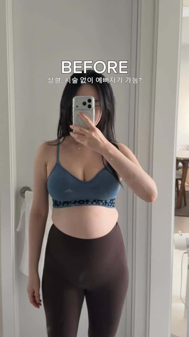 chichipresso 게시물 이미지: 저처럼 평범한 사람이 성형, 시술없이
가장 빠르게 예뻐지는 방법은 딱...