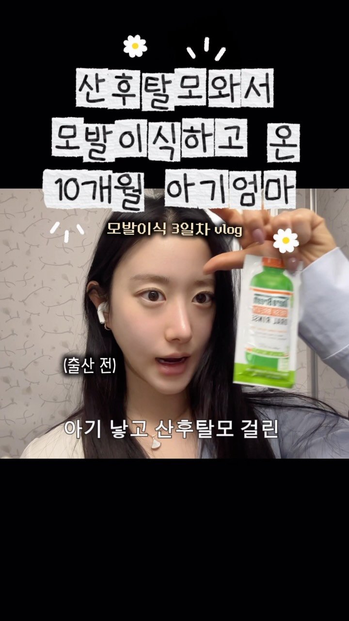 chichipresso 게시물 이미지: 헤어라인교정 모발이식 4일차 vlog

실시간 후기는 인스타 스토리로 보여드리고...