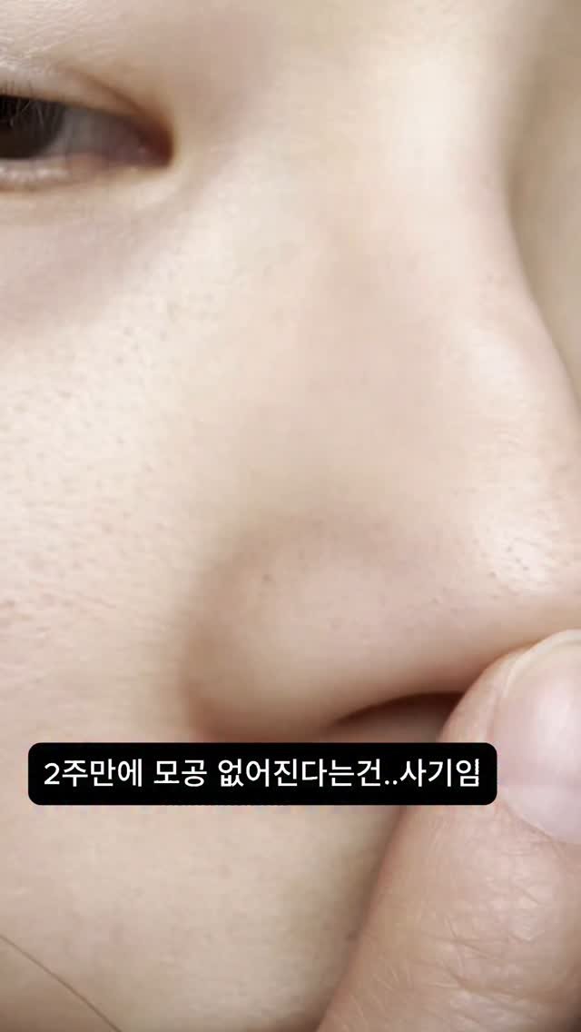 chuchu.mimi1 게시물 이미지: 진짜 하루이틀만에 모공 쪼여진다는것들는 대체 뭐냐 속지마세요