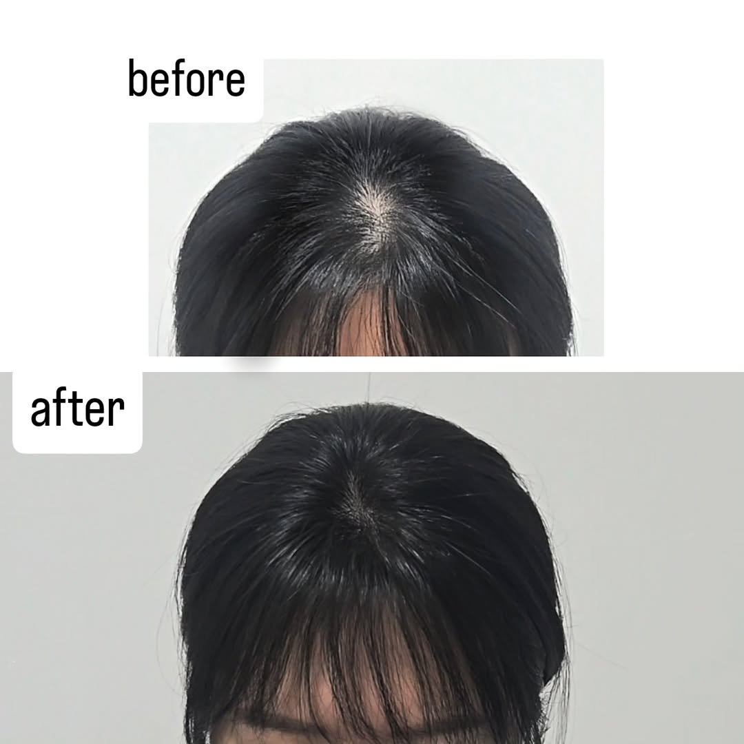 Photo by 검단두피문신 | 눈썹문신 | 입술•아이라인  멜라닌 케어 | 커버핏 대표원장 허은선 in 검단신도시. May be an image of one or more people, hair and text that says 'before after'.