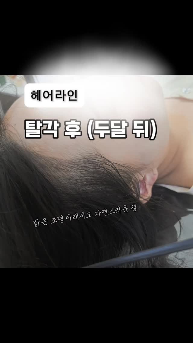 coverfit_beauty 게시물 이미지: 헤어라인 및 모든 반영구 시술은
시술 직후보다 탈각 후가 더 중요합니다❗️

직후의...