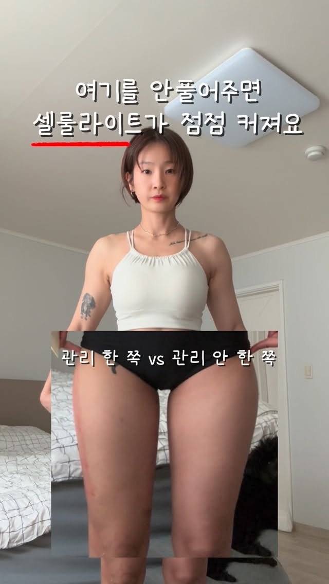 crush_kimcoka 게시물 이미지: 📌 아무리 관리해도 허벅지 안빠지는 사람🤚

하루 종일 앉아있고 아무리 운동하고...