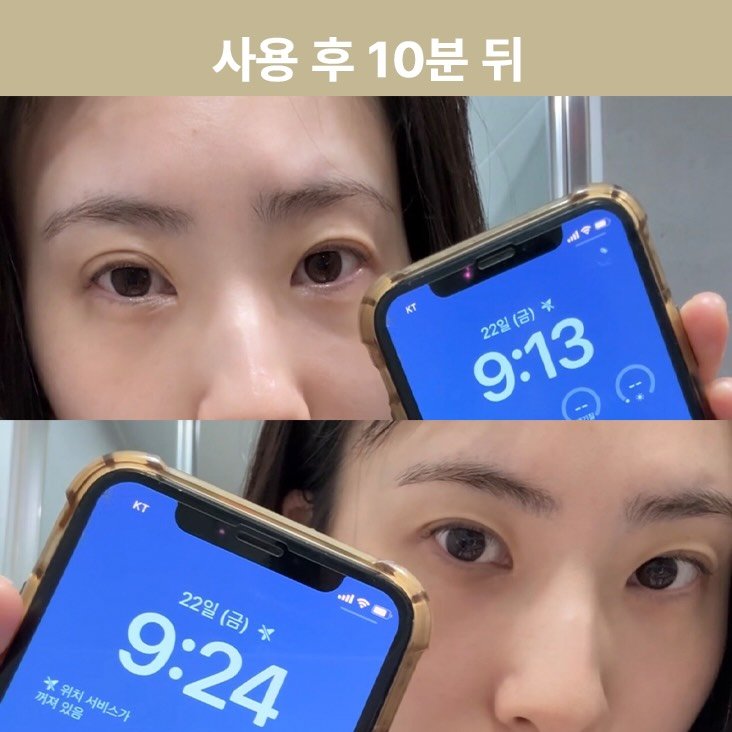 crystal__yoga 게시물 이미지: 많은 분들이 아로마가 붓기에
왜 효과가 있는지 궁금하실 것 같아요

에센셜 아로마...