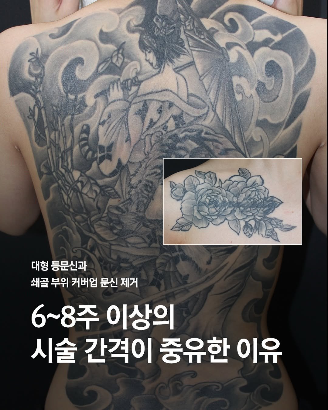 Photo by 주 on March 25, 2026. May be an image of one or more people, tattoo and text that says '대형 등문신과 쇄골 부위 커버업 문신 제거 6~8주 이상의 시술 간격이 중유한 이유'.