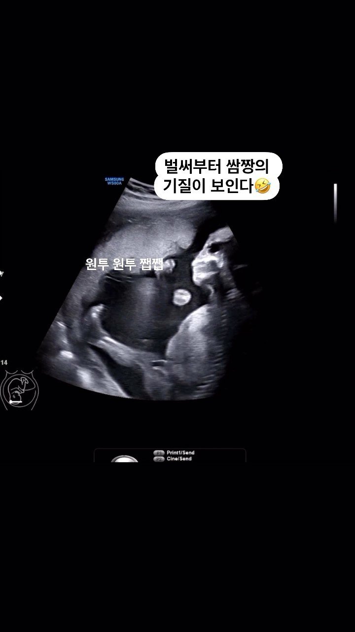 da._.ee_ 게시물 이미지: 드디어 어제는 정밀초음파 보고왔어요 !!!
넘 기다렸던 한 달만의 돌아온 시간...