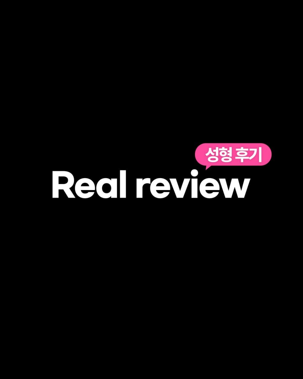da_plastic_surgery 게시물 이미지: 제 추구미인 고양이상 꿈을 이뤘어요 !
눈 재수술, 코수술, 윤곽 성형하고...