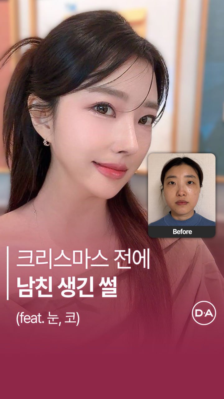 da_plastic_surgery 게시물 이미지: 솔크 탈출 ! 즐거운 크리스마스 보내세요🎅🏻🎄

💌상담문의
전화...