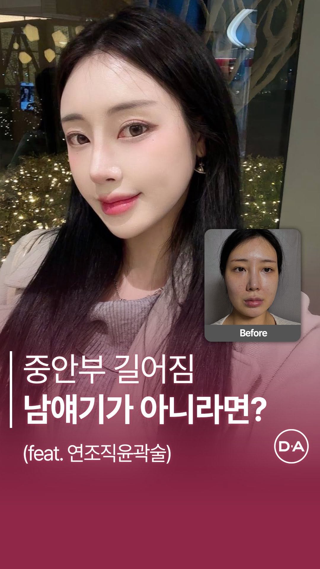 da_plastic_surgery 게시물 이미지: 롱안부될까봐 무서운 사람 😓
💌상담문의
전화 02-515-4600
카톡...