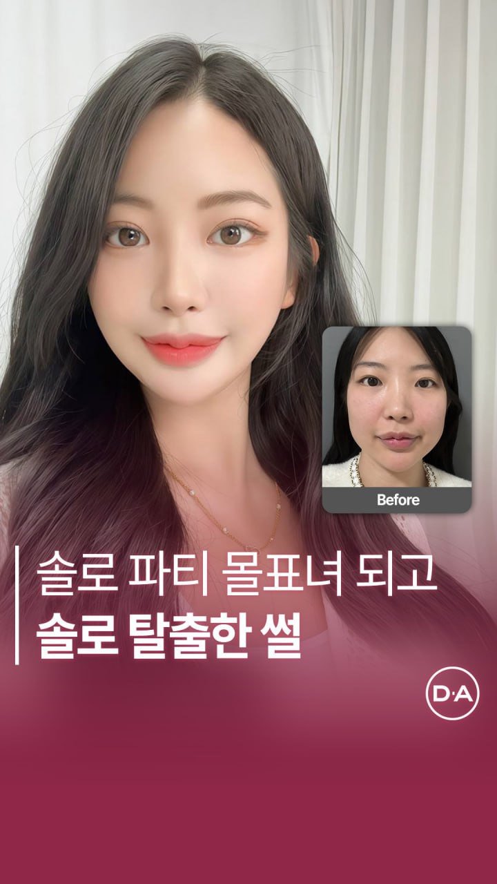 da_plastic_surgery 게시물 이미지: 솔로 파티에서 몰표받고 솔로 탈출하고 싶은 사람? 🙌

💌상담문의
전화...