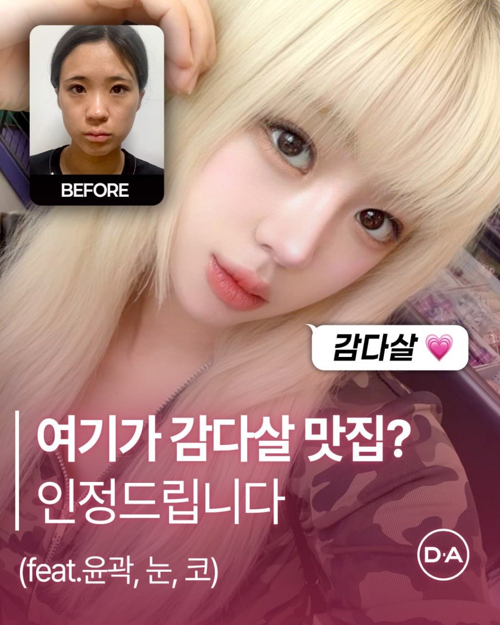 Photo by 예쁘면 DA야! 디에이성형외과 on December 11, 2025. May be an image of one or more people, hair and text that says 'BEFORE 감다살 여기가 감다살 맛집? 인정드립니다 (.윤곽, 윤곽,눈,코) 윤곽, 눈, (feat. 눈,코) 코) DA D.A'.