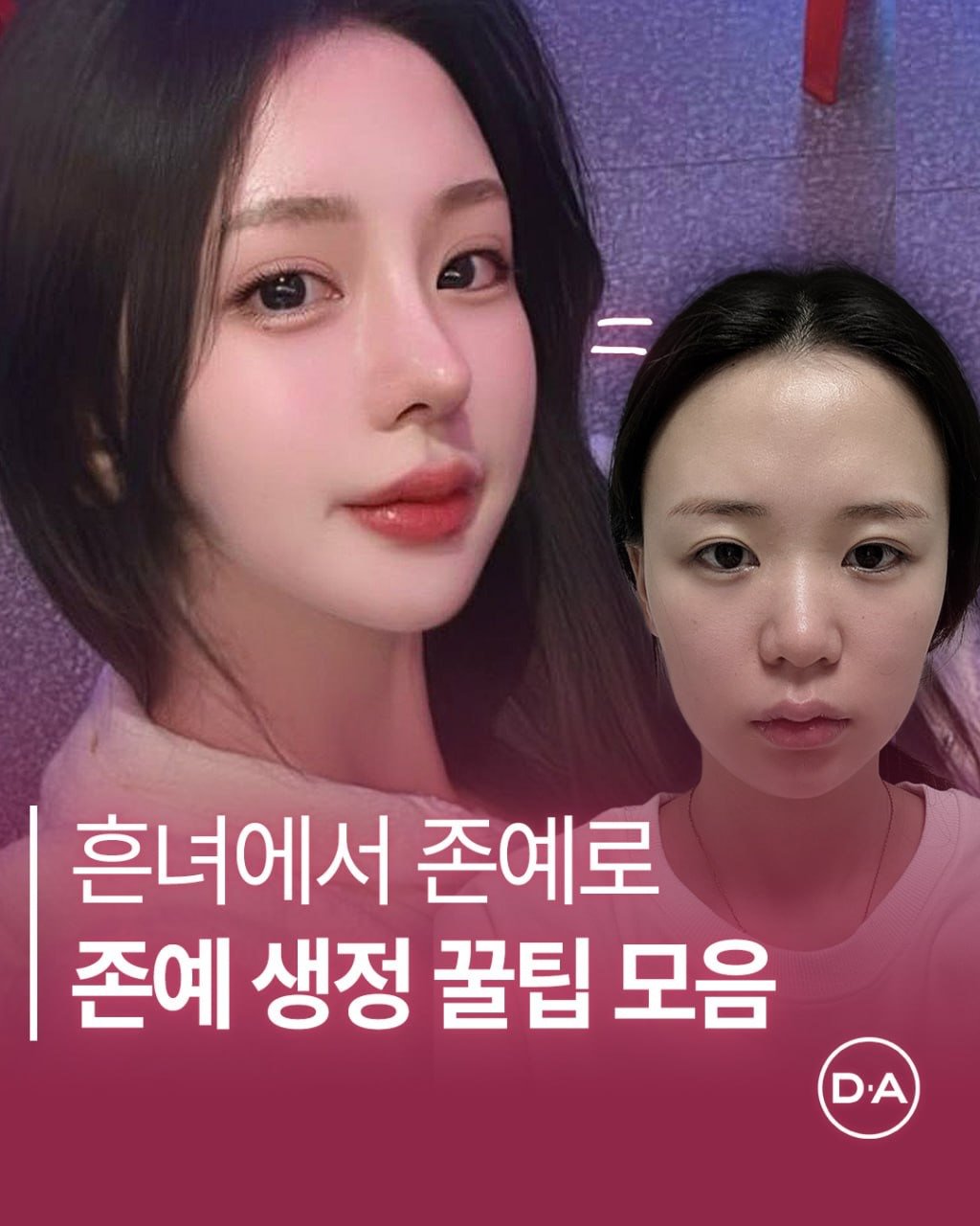 Photo by 예쁘면 DA야! 디에이성형외과 on February 09, 2026. May be an image of text that says '흔녀에서 존예로 존예 생정 꿀팁 모음 D.A'.