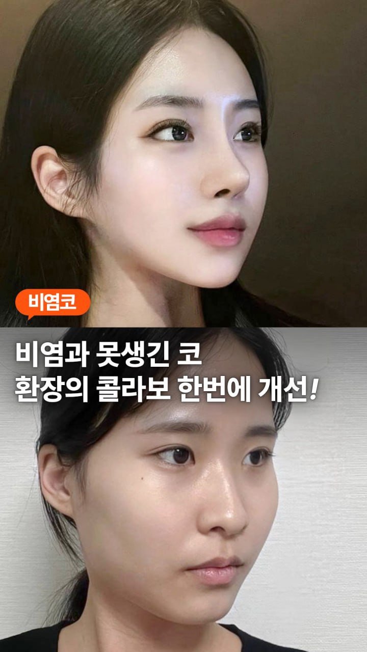 da_plastic_surgery 게시물 이미지: 비염과 못생긴 코를 한번에 개선 🙌🏻

💌상담문의
전화...
