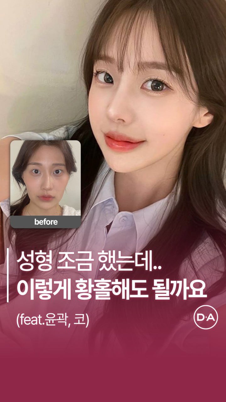 da_plastic_surgery 게시물 이미지: 내 얼굴 내가 봐도 황홀해요 🫶🏻

💌상담문의
전화 02-515-4600
카톡...