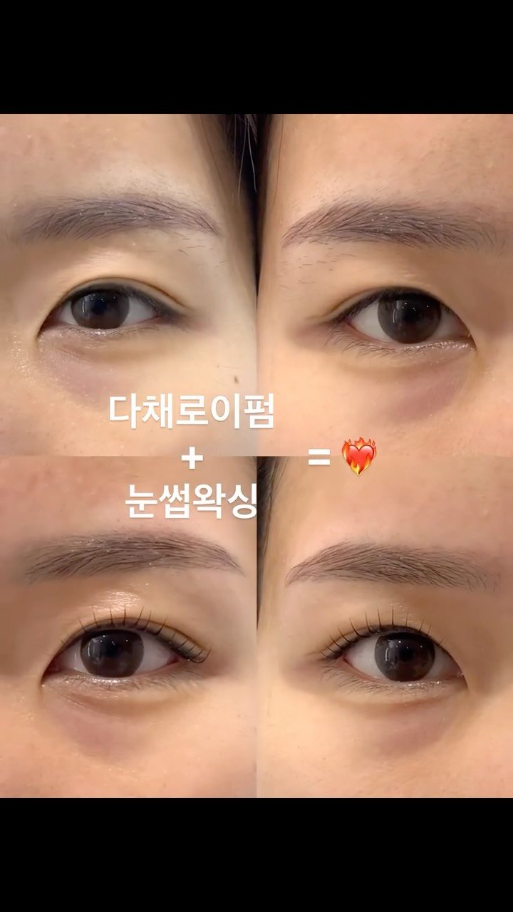 dachaeroe_e 게시물 이미지: 같은 눈,
같은 사람 맞습니다 👀

앞피드에서 공개했던 고객님 앞모습...
