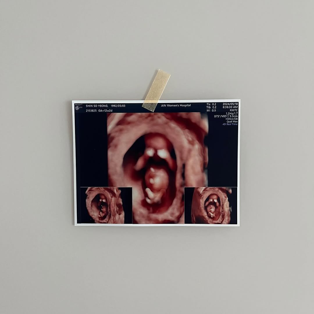 daldal._.table 게시물 이미지: #임밍아웃

저희 부부에게도 소중한 선물이 찾아왔어요👶🏻
요리피드만 올리다가 이렇게...