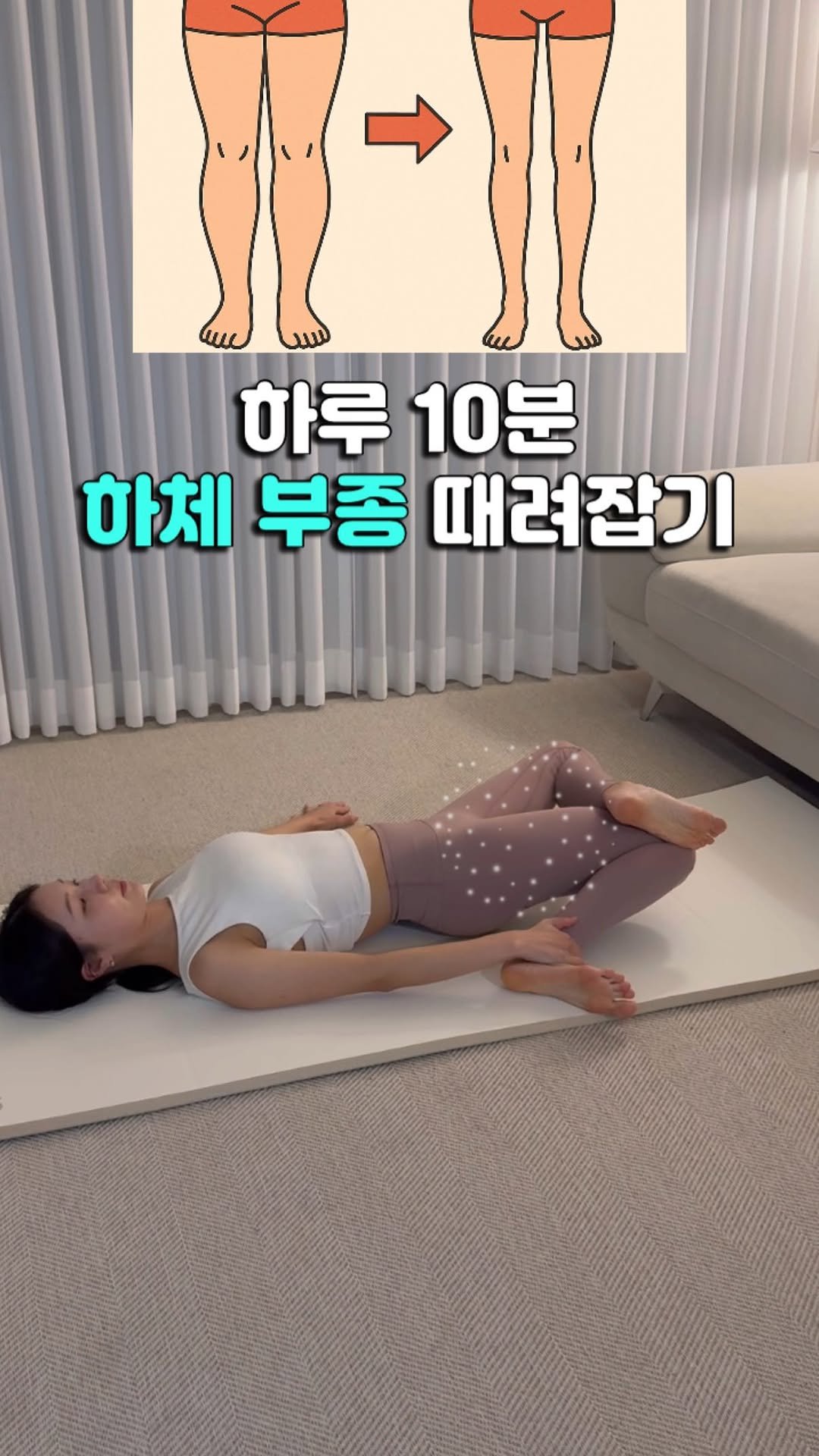 daoom_yeoon 게시물 이미지: 아무리 운동해도 다리 붓기가 
쉽게 빠지지 않으시나요?
👉🏻 문제는 지방이 아니라...