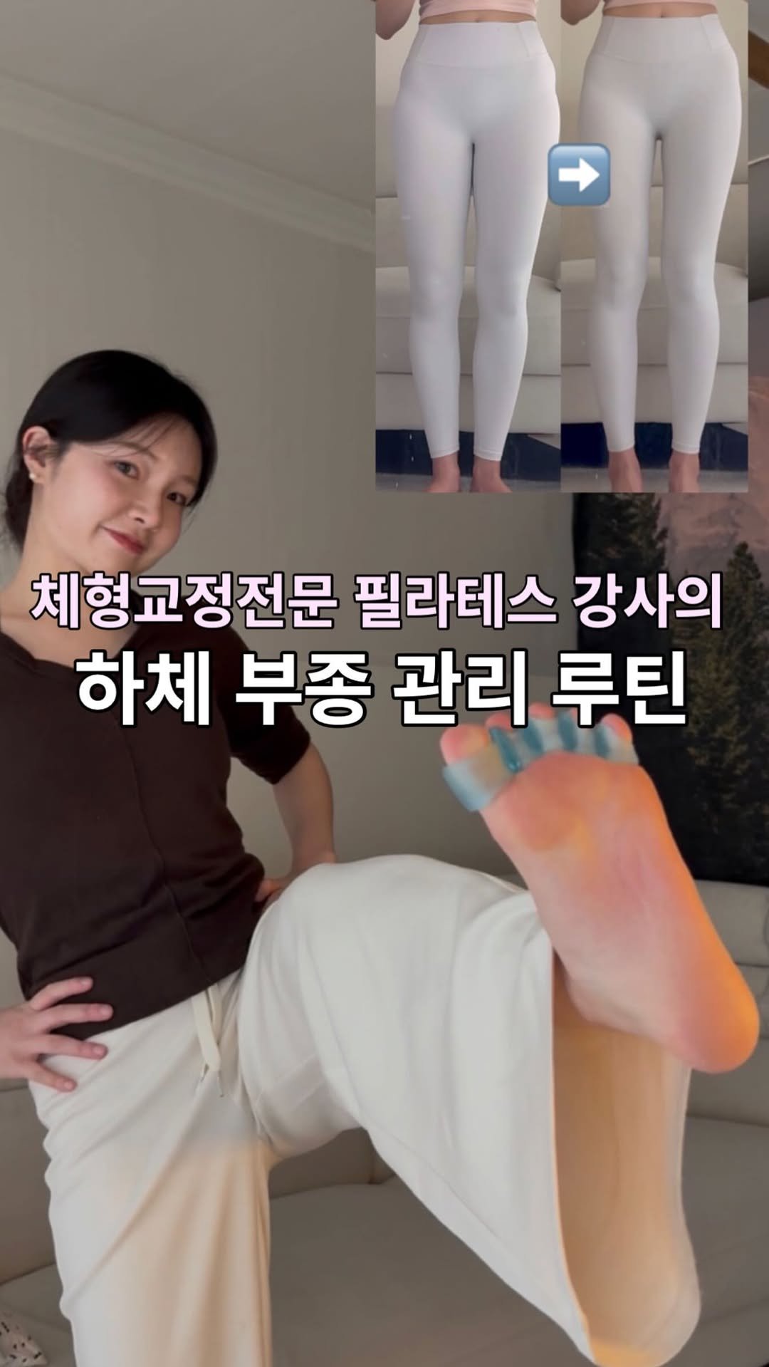 daoom_yeoon 게시물 이미지: #하체부종

하루 종일 서서 수업하는 저는
저녁만 되면 양말 자국은 기본,
발이...