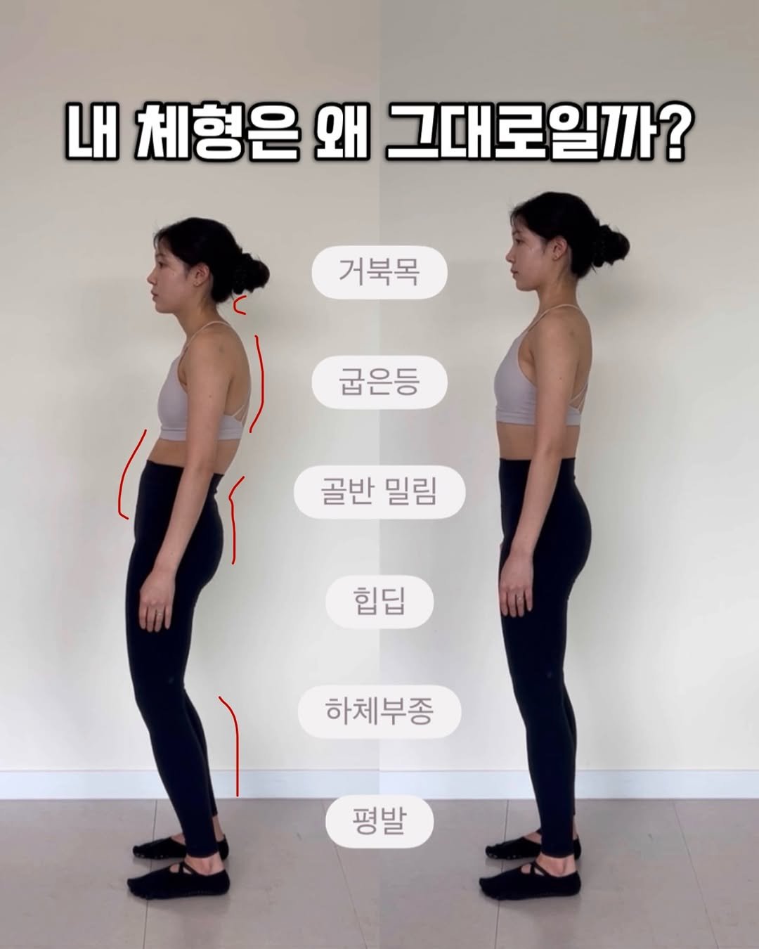 Photo by 여온쌤 | 다움바디스튜디오 원장 on February 11, 2026. May be an image of text that says '내 체형은 왜애 그대로일까? 거북목 굽은등 골반 밀림 힙딥 힙딥 하체부종 평발'.