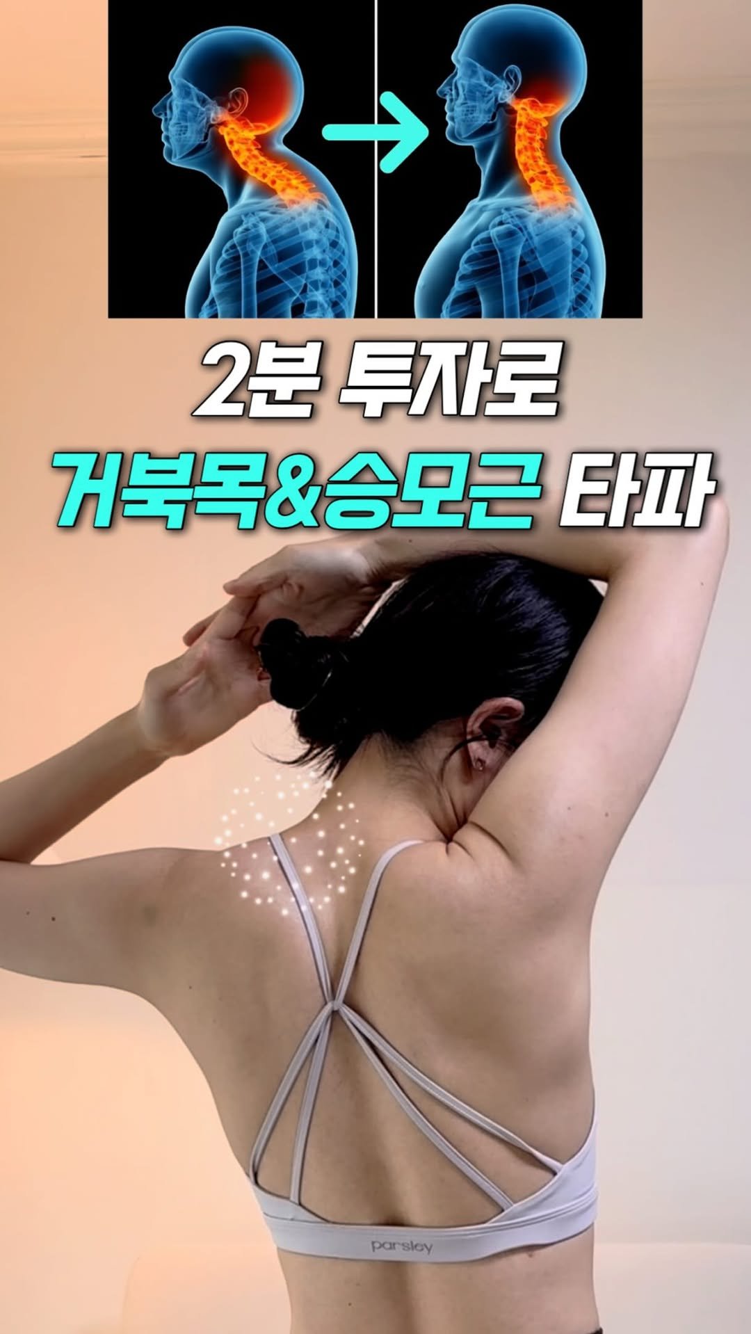 daoom_yeoon 게시물 이미지: 아침에 자고 일어났는데

목 뒤부터 윗등까지 전부 굳어서
“누가 좀 뜯어줬으면...