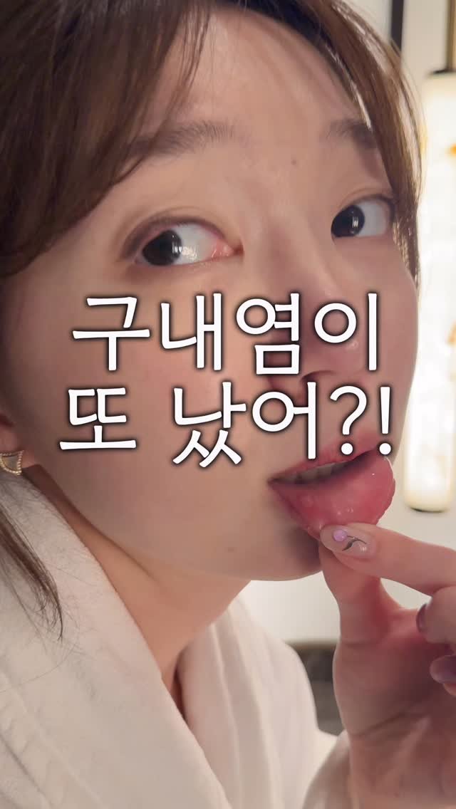 dasik.yaksa 게시물 이미지: 🙋🏻♀️구내염 대장 약사의 팁
저 구내염이 정말 많이 나요
어렸을 땐 한번에...