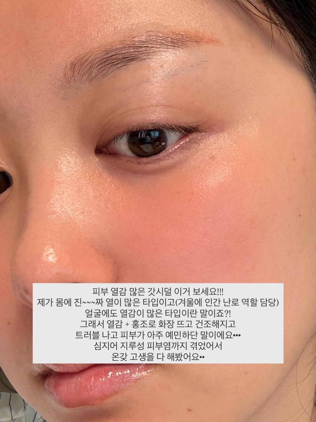 Photo by 또비니 DDOBINI on April 13, 2026. May be an image of one or more people and text that says '피부 열감 많은 갓시덜 이거 보세요!!! 제가 몸에 진~~~짜 열이 많은 타입이고(겨울에 인간 난로 역할 담당) 얼굴에도 열감이 많은 타입이란 말이죠?! 그래서 열감+ 홍조로 화장 뜨고 건조해지고 트러블 나고 피부가 아주 예민하단 말이에요... 심지어 지루성 피부염까지 겪었어서 온갖 고생을 다 고생을다해봤어요.. 해봤어요..'.
