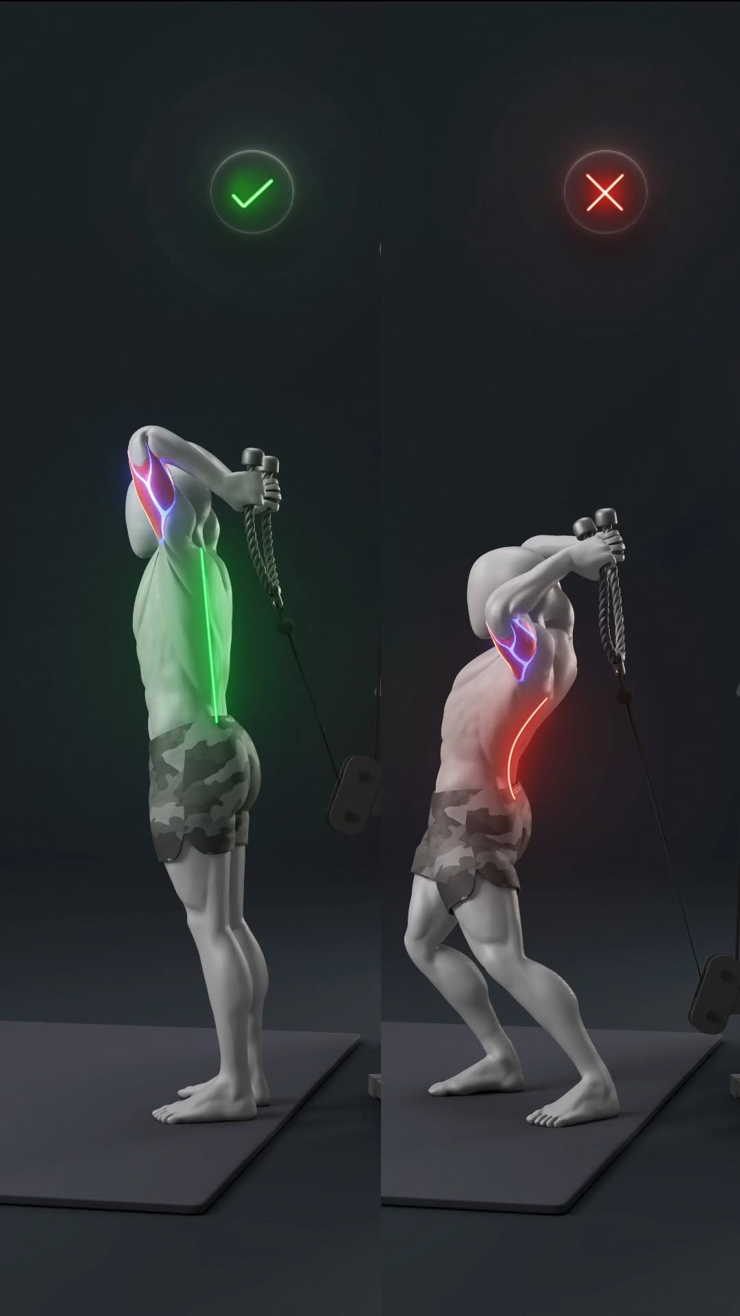 demicstory 게시물 이미지: 🔥Most People Set Up Overhead Cable Tricep...