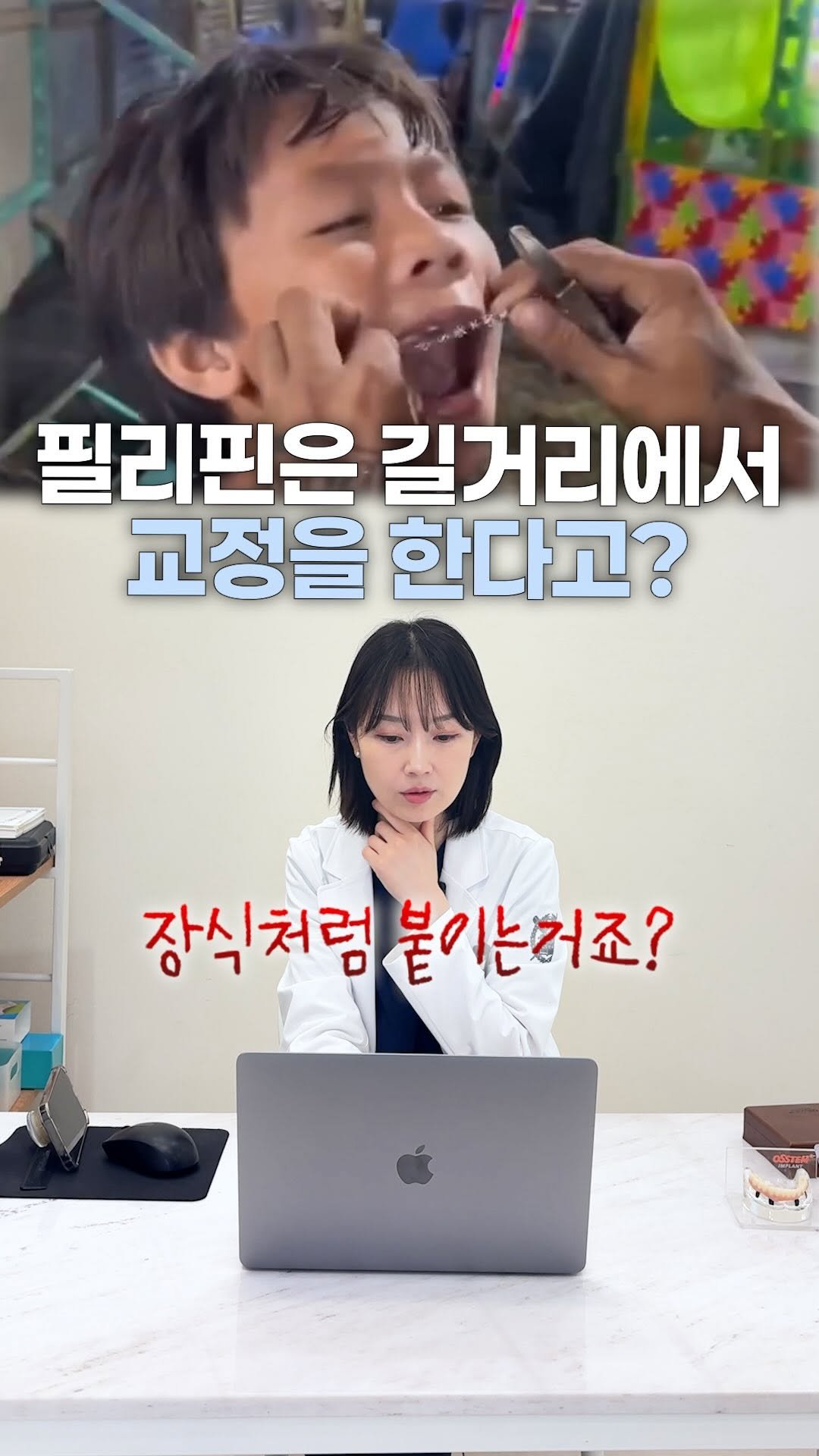 dentist_sujin 게시물 이미지: 필리핀에서 파는 500원 교정기?!

실제 효과가 있는지 궁금하다고 하셔서
준비해봤습니다☺️