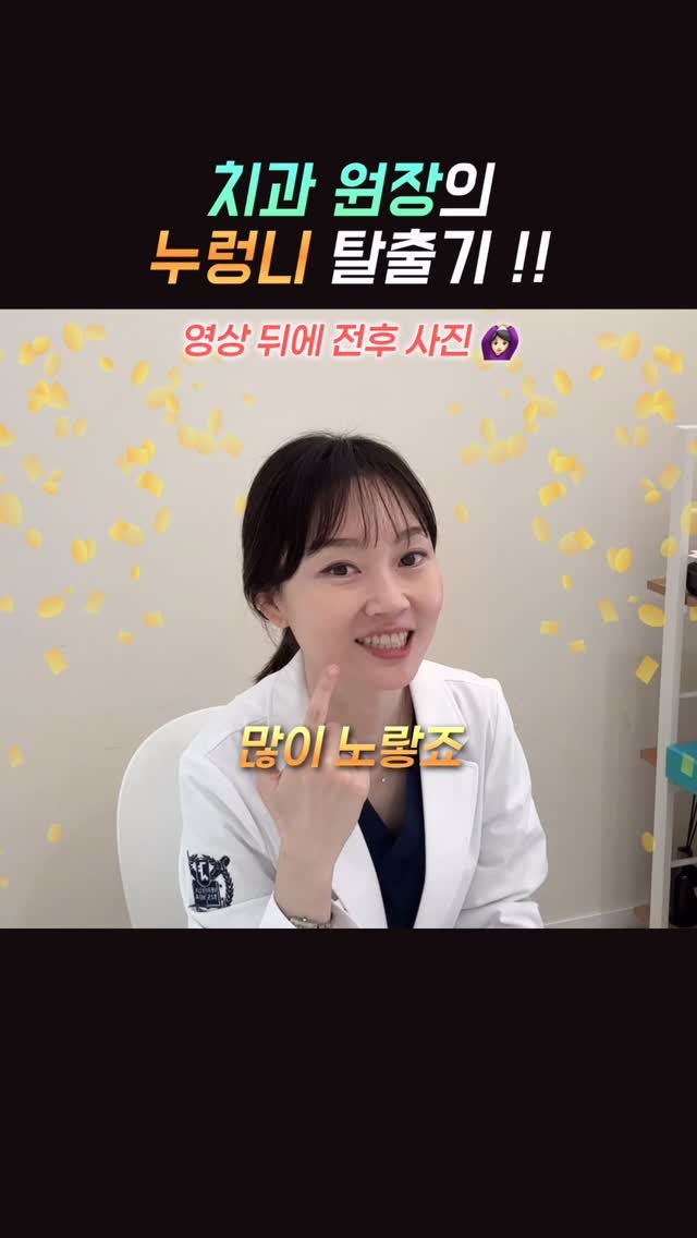 dentist_sujin 게시물 이미지: 저의 미백 과정 & 전후 사진 입니다🩵
사진에 밝음이 잘 안 담겨서 아쉽지만,...