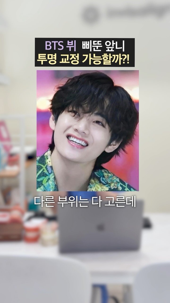 dentist_sujin 게시물 이미지: 벽이 느껴집니다 완벽💜 (스마일 라인 월드컵하며 발견했을 뿐… 그 전까지 전혀...