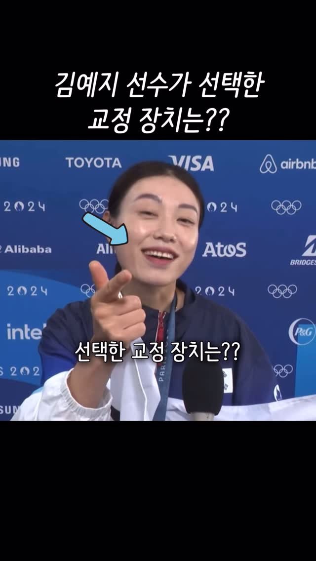 dentist_sujin 게시물 이미지: 보면서 인비절라인 딱일거라 생각했던🙌
김예지 선수 !
벌어져 있는 앞니 모으는...