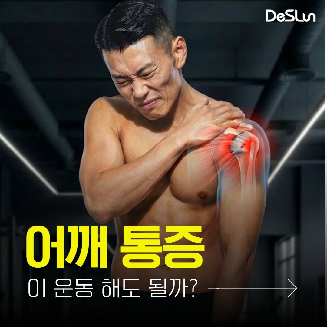 deslun_hong 게시물 이미지: 최신 어깨 재활 연구에서 강조하는 개념
SSMP (Shoulder Symptom...