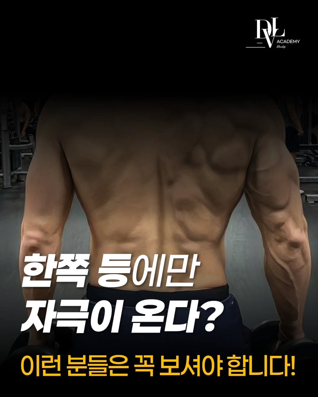 develop_hyeok 게시물 이미지: ​"똑같이 당기는데 왜 왼쪽 등만 텅 빈 느낌일까요? 🤔"

​운동 좀 하시는...