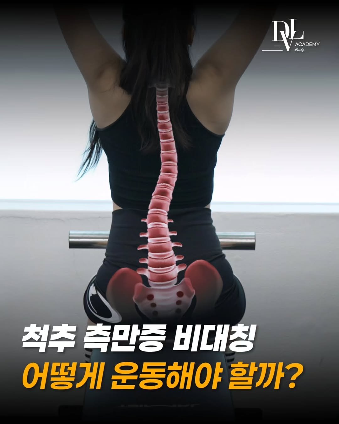 develop_hyeok 게시물 이미지: < 댓글에 ' 측만증 ' 작성 해주시면 강의 할인 쿠폰을 드립니다. >

측만증에...