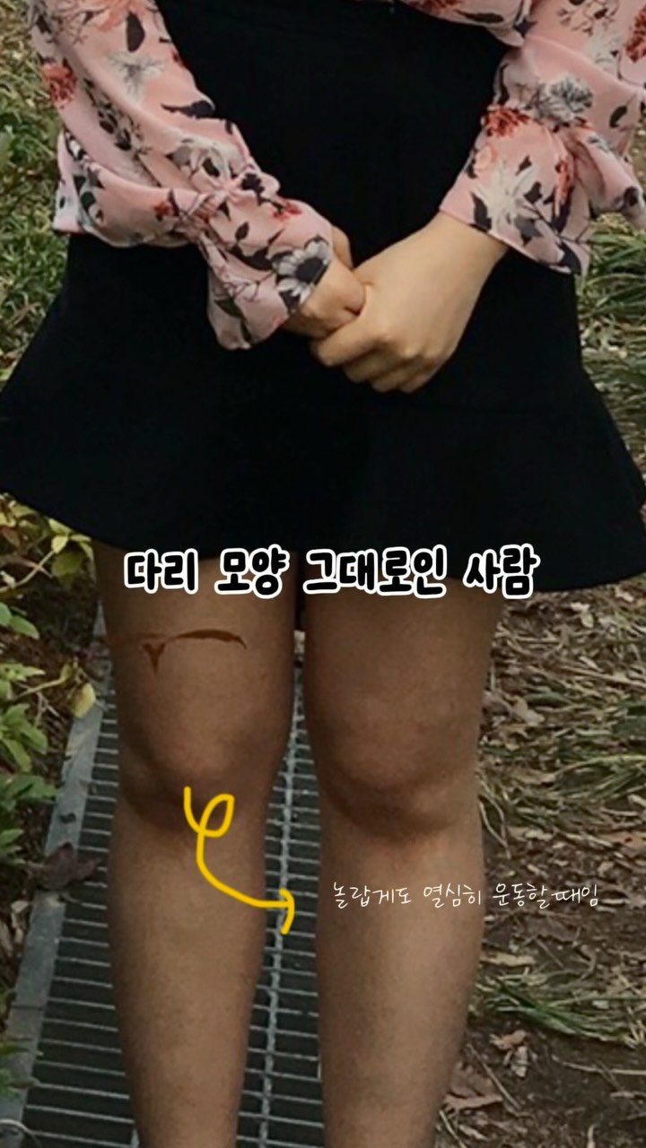 dewlike_this 게시물 이미지: 운동해도 다리 살 안빠지는 사람 특징
알려드릴게요 👀
사실 운동도...
