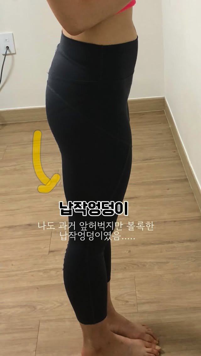 dewlike_this 게시물 이미지: 걸을때 허리가 아픈 사람은
대부분 납작엉덩이... 🤔

엉덩이를 못쓰는...