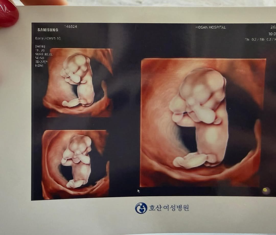 dgeneva___ 게시물 이미지: (한달 동안 조용 했던 이유)

#임밍아웃 ✨

임신 했슈~ 결혼 할때가 되서...