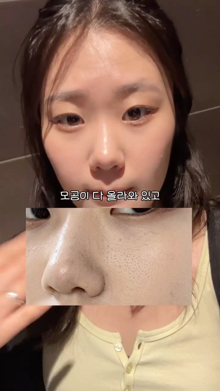 diet_jiwon_0 게시물 이미지: 민망한 상황 대처법

여름이라 화장 다 뜨고 모공부각돼서 고민이셨던 분들 이거 꼭...