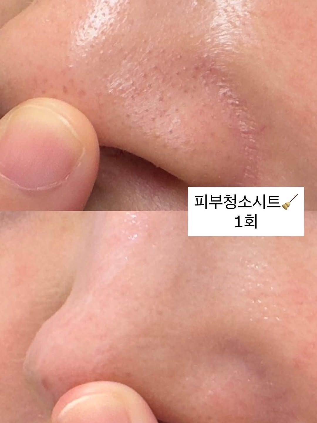 Photo by 디오아르 권유주 on April 28, 2026. May be an image of text that says '피부청소시트 1회'.