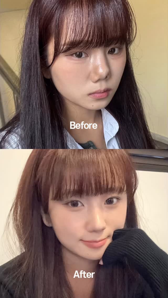 dl_plastic_official 게시물 이미지: 수술 내용이 궁금하다면 댓글에 ‘구축코‘ 를 달아주세요!
디엘로...