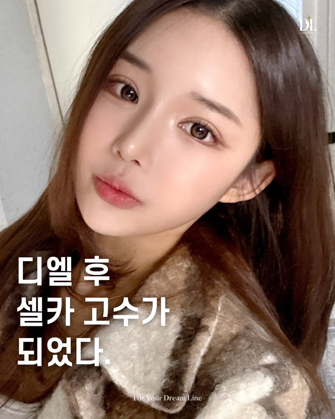 Photo by 디엘성형외과 | 최적의 프로필라인 설계 on February 03, 2026. May be an image of one or more people, hair and text that says '디엘후 후 셀카고수가 셀카 고수가 되었다. forYourDreamLine For Your Dream Line PorYour'.