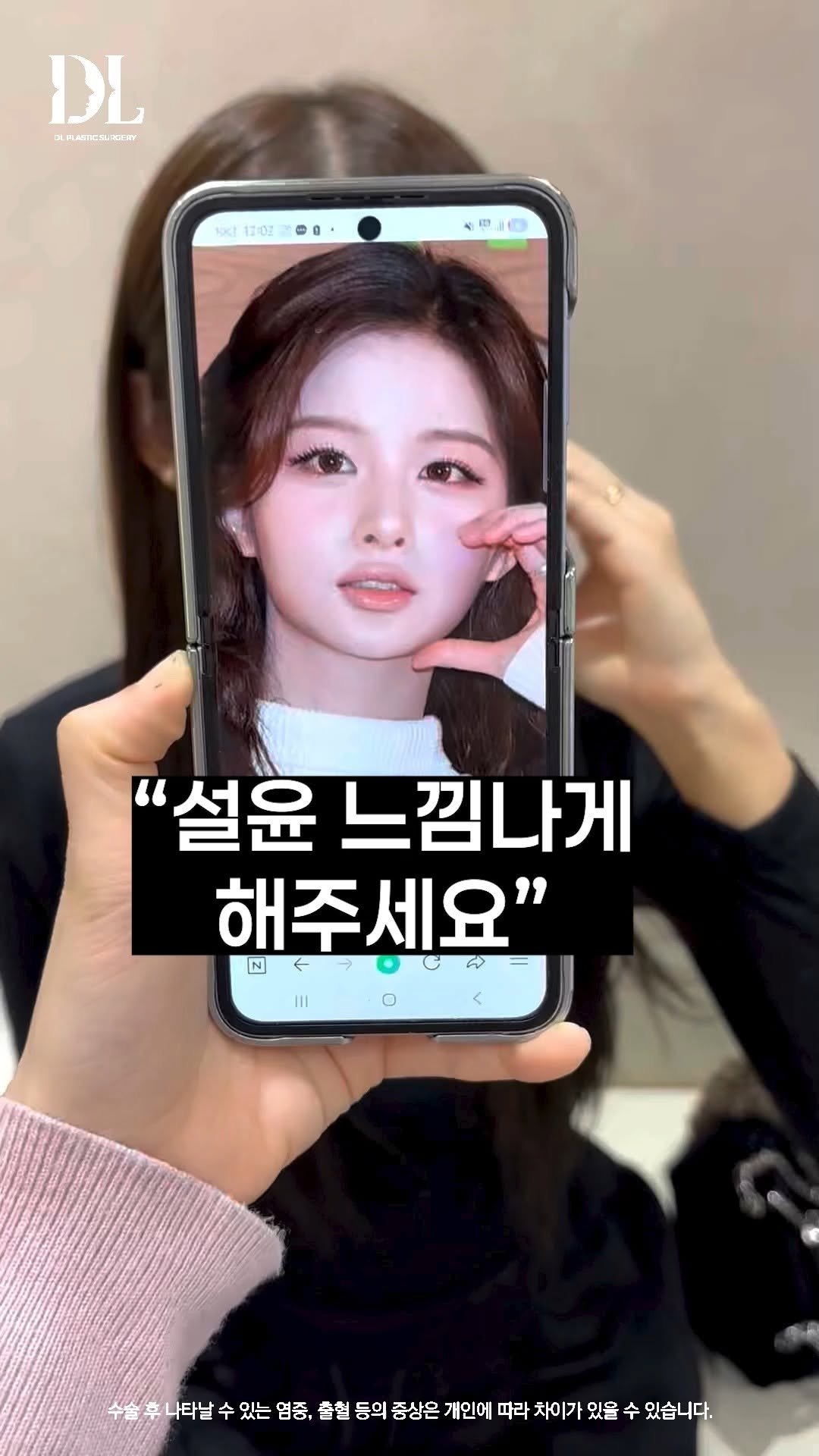 dl_plastic_official 게시물 이미지: 수술 내용이 궁금하신 분들은 댓글에 '설윤'을 달아주세요! 

원장님께 설윤 닮게...