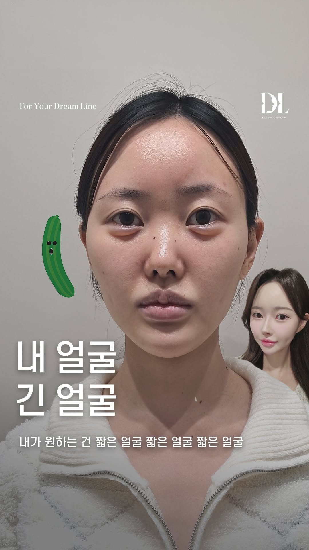 dl_plastic_official 게시물 이미지: #정보공유 긴 얼굴 탈출하고 짧은 얼굴된 정보가 궁금하다면 댓글에 "긴얼굴"...
