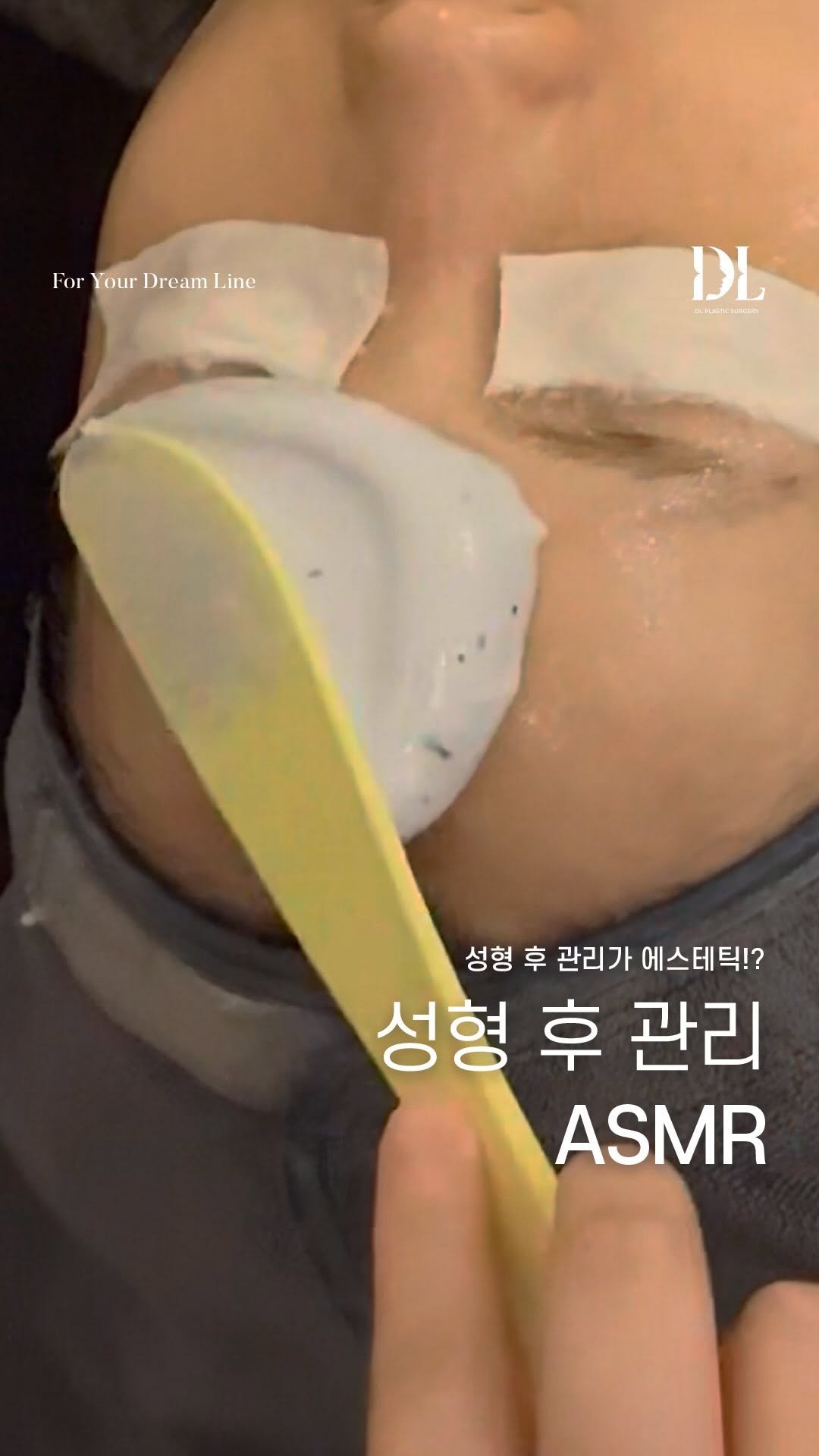dl_plastic_official 게시물 이미지: 예뻐지고 받는 첫 관리 ASMR..♥