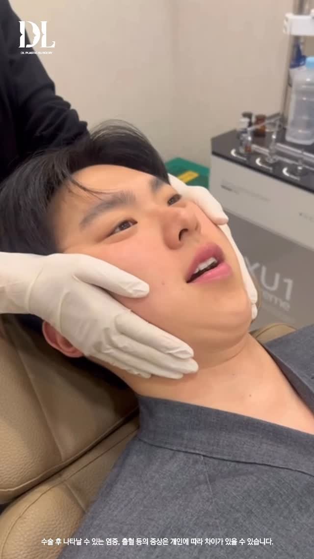 dl_plastic_official 게시물 이미지: #정보공유 놀라운 변화가 궁금하다면 댓글에 ”정보공유“ 라고 남겨주세요! 😱😍

#남자성형