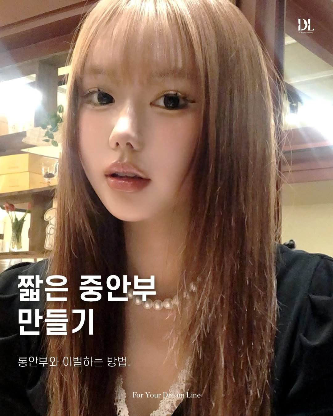 Photo by 디엘성형외과 | 최적의 프로필라인 설계 on October 17, 2025. May be an image of one or more people, hair and text that says '٦۱ 짧은 중안부 만들기 롱안부와 이별하는 방법. For Your ForYourDreamLine Dream Line'.